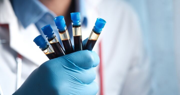 Blood Type & Your Future Health